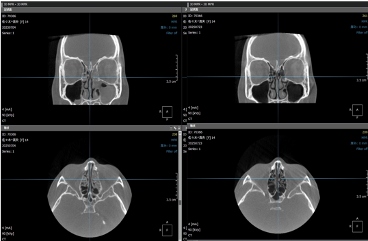 鼻の症状について相談する患者